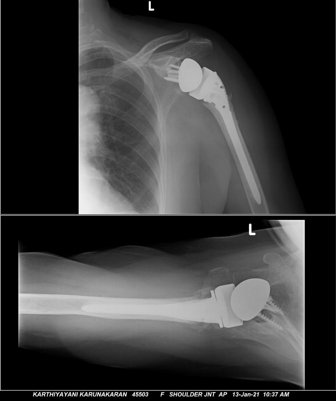 xray image